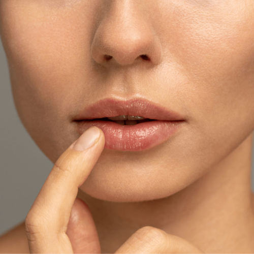 Woman showing her lips after having lip fillers