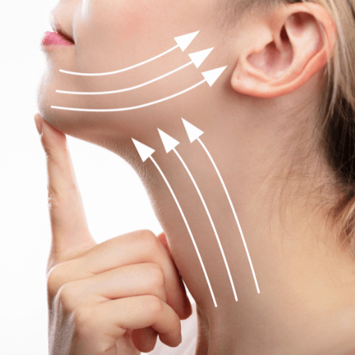 Jaw contour with dermal fillers